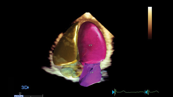 Inteligencia anat&oacute;mica para ultrasonidos