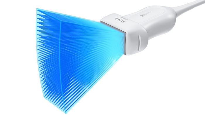 Transductor de array lineal XL14-3 xMATRIX para evaluaciones vasculares de Philips con capacidad 3D/4D