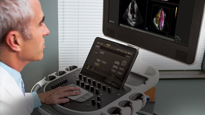 Complejidad en la ecocardiograf&iacute;a (Download .pdf)