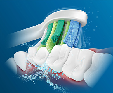 Evaluación clínica del cabezal de cepillado Philips Sonicare InterCare
